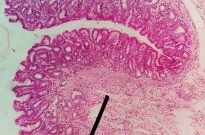 histopathology-img6a